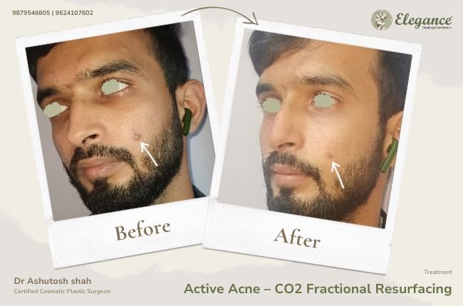 Face Makeover Gallery by Dr. Ashutosh, Surat