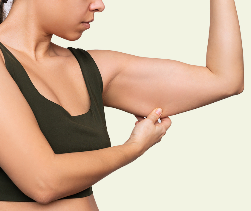 Arms Liposuction