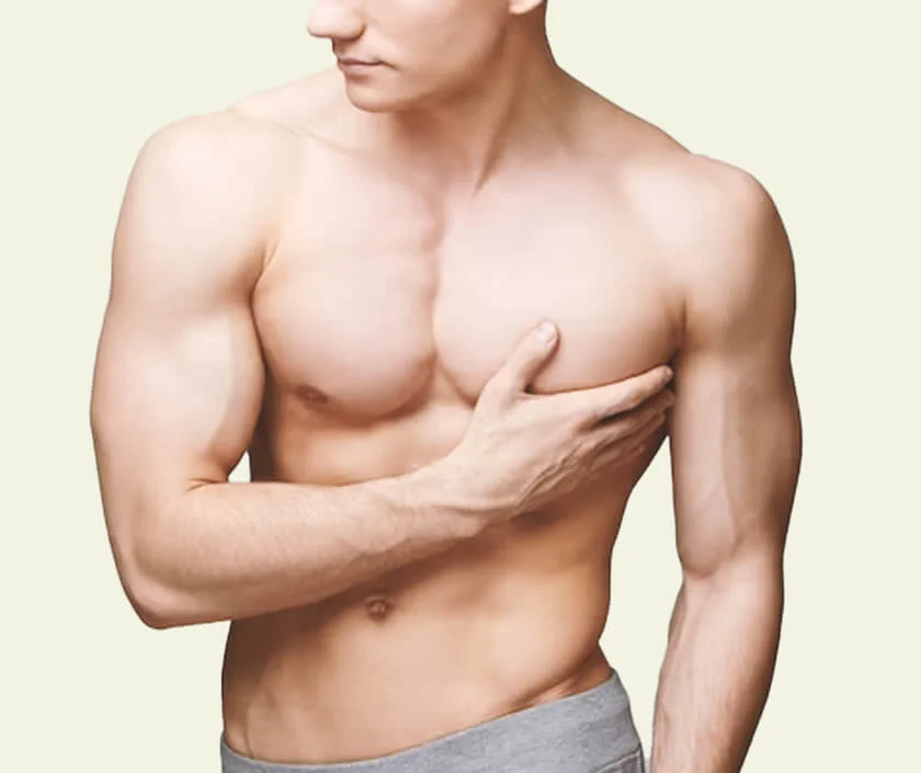 Type 3 Gynecomastia – Slight Breast Roll