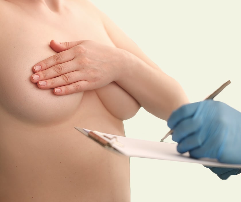 Axillary Breast Surgery