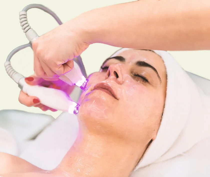 Laser for Acne & Scar