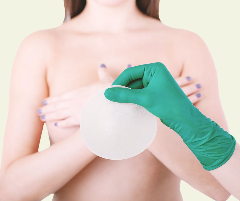 Breast Implant Removal & Replacement