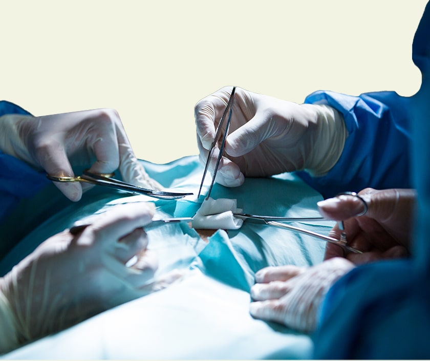 Penile Implant Surgery