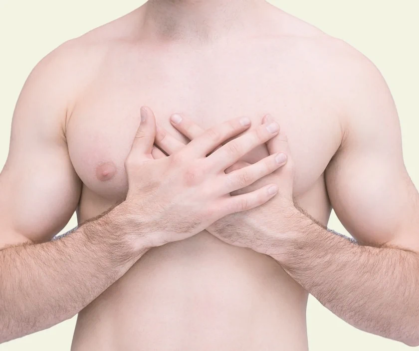 Unilateral Gynecomastia