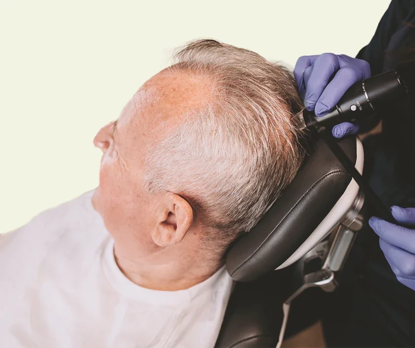 Hair Transplant For Elderly People