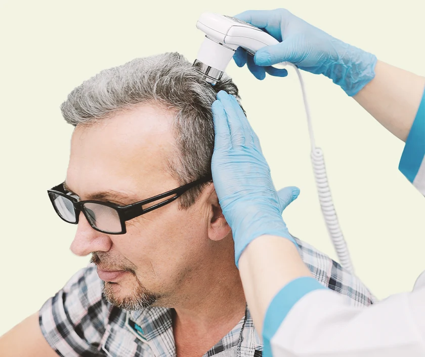 Hair Transplant In White Hair