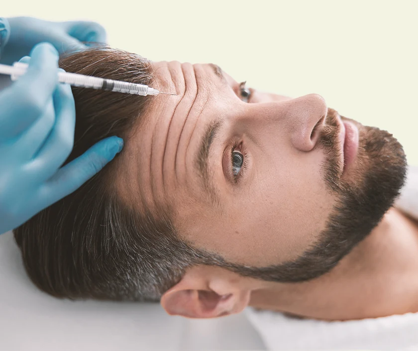 Hair Transplant – mesotherapy