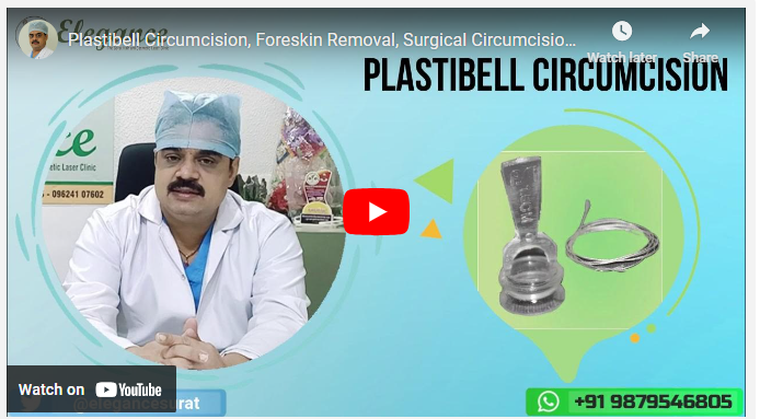 Plastibell Circumcision Elegance Clinic