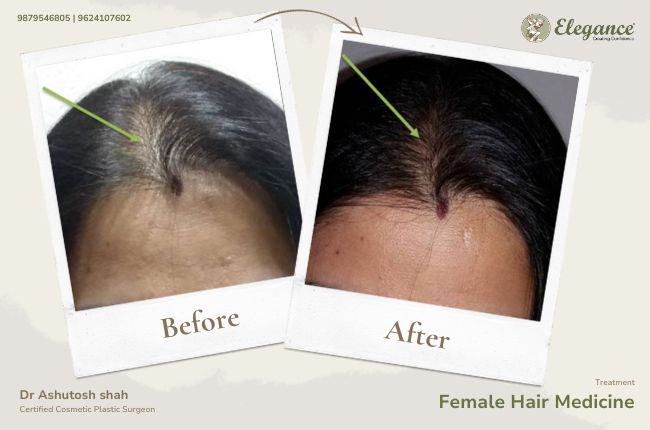 Female Hair Medicine (2)