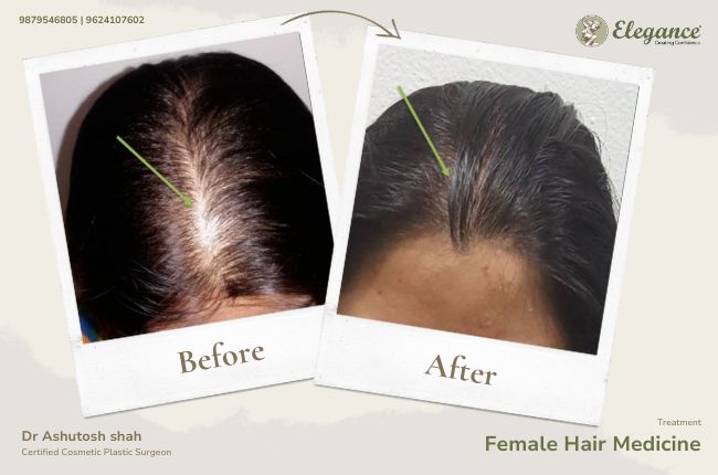 Female Hair Medicine (3)